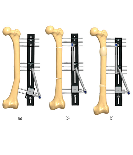 Femur_DefLength_4.jpg