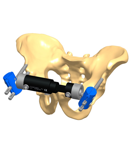 2A5 Fractures and disruptions